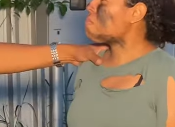 H0409008 Que coração bom tem esse médico, caiu um cisco no meu olho part2